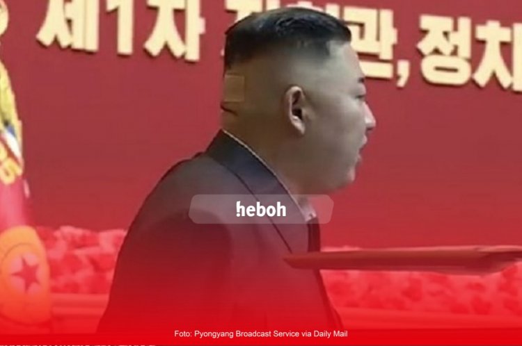 Ada Perban di Kepala Pemimpin Korut, Kim Jong Un. Ini Menjadi Pertanyaan Warga Dunia
