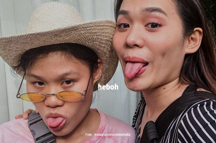 Tak Pernah Terekspos, Kakak Kandung Sheryl Sheinafia Ternyata Petani Disabilitas Sukses