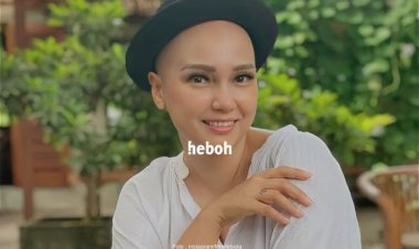 Sembuh dari Kanker, Feby Febiola Pamer Kulit Wajahnya Jadi Lebih Mulus