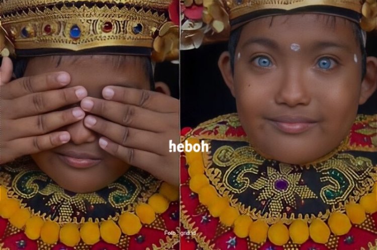 Sosok Ketut Adi Putra, Bocah Asli Bali yang Memiliki Mata Berwarna Biru