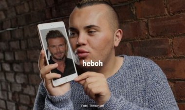 Demi Mirip David Beckham, Pria Ini Habiskan Rp300 Juta untuk Operasi Plastik