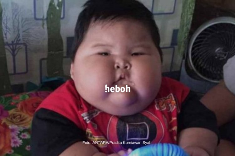 Viral Bayi 16 Bulan dengan Berat 27kg di Bekasi Jalani Pemeriksaan Rutin Karena Obesitas