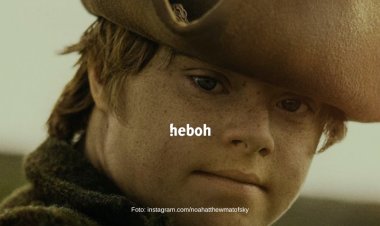 Pertama Kali! Disney Rekrut Aktor Down Syndrome, Bintangi Film 'Peter Pan"