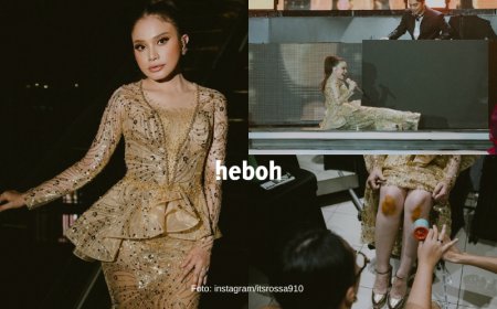 Terjatuh di Panggung dan Alami Luka Ringan, Rossa Tetap Profesional: Queen Behavior!