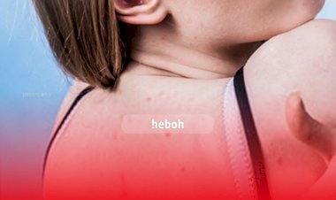 Mau Menghilangkan Jerawat di Punggung? Pakai 5 Cara Ini Deh, Dijamin Manjur!