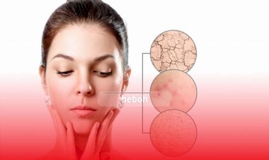 Cegah Sebelum Terlambat, Berikut Ini Kesalahan Pakai Skincare yang Bisa Merusak Wajah