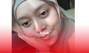 Dinobatkan Menjadi Wanita Kelima di Dunia, Ini Potret Lesty Kejora Tanpa Makeup