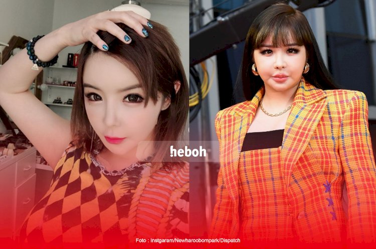 Netizen Syok Lihat Wajah Park Bom Eks 2NE1 Berubah Drastis
